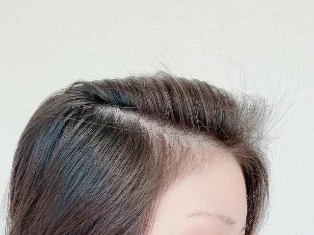 髪を下ろす女性の分け目　クローズアップ