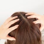 【医師監修】頭皮の日焼けの症状と対処法｜ヒリヒリ・皮むけ・抜け毛を防ぐケアと予防方法