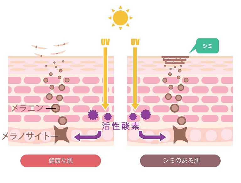 シミができる図説　イラスト