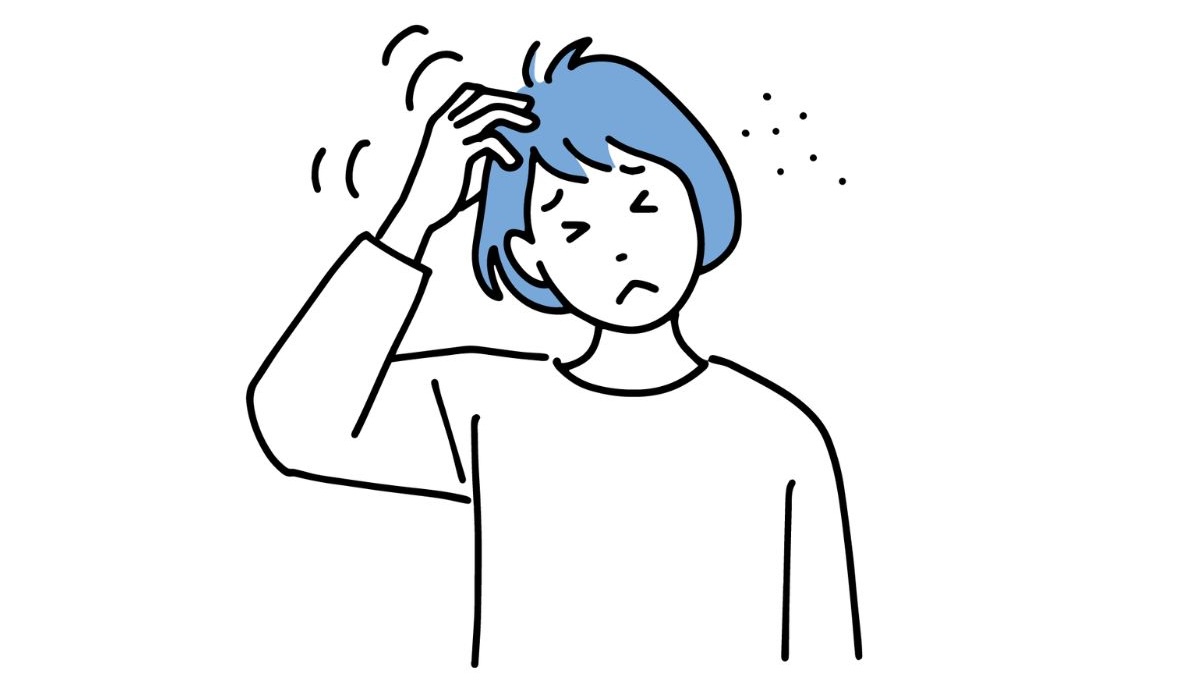 頭をかく女性のイラスト