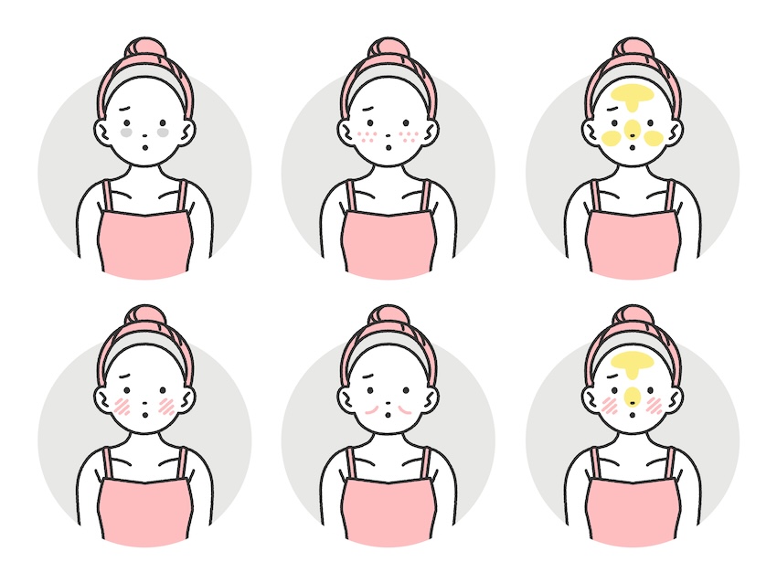異なる肌トラブルや肌タイプ　6つの差異　イラスト